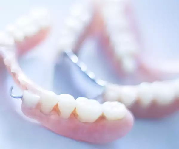 پروتز دندان در دندانپزشکی در شهریار کلینیک کیمیا