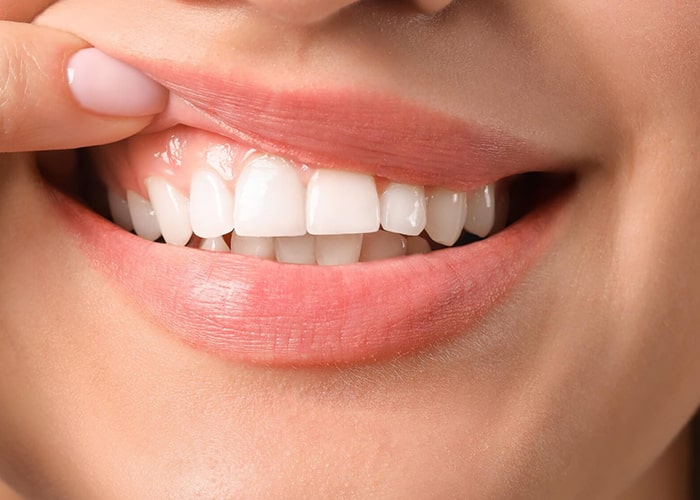 سلامت لثه با معاینه در کیلینیک دندانپزشکی در شهریار
