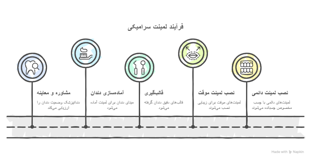 مراحل انجام لمینت سرامیکی