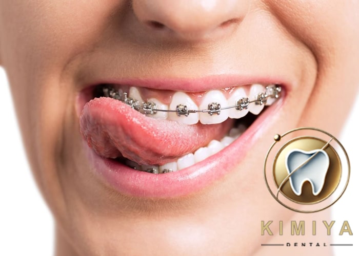 متخصص ارتودنسی در شهریار