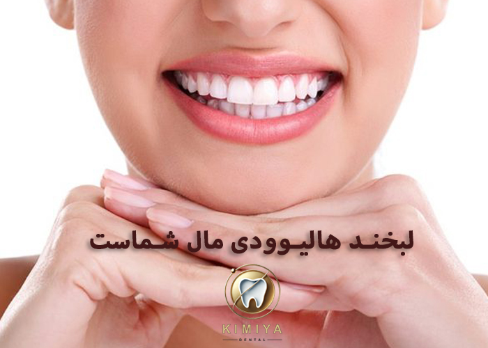 دندانپزشکی زیبایی در شهریار