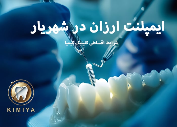ایمپلنت ارزان در شهریار در کلینیک کیمیا