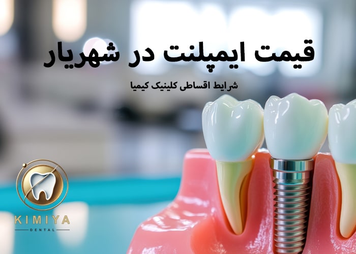 قیمت ایمپلنت دندان در شهریار کلینیک کیمیا با قیمت های 1404