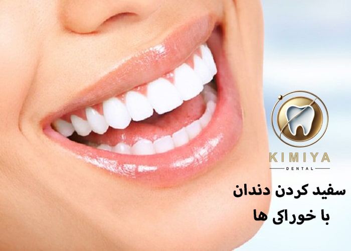 ۵ ماده غذایی جادویی که دندونات رو برق میندازن