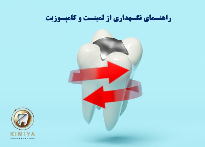 راهنمای نگهداری از لمینت و کامپوزیت