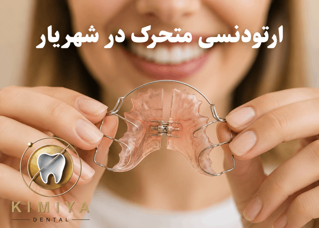 ارتودنسی متحرک در شهریار در دندانپزشکی کیمیا