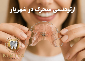 ارتودنسی متحرک در شهریار در دندانپزشکی کیمیا
