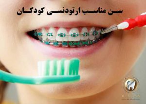 ارتودنسی کودکان در شهریار