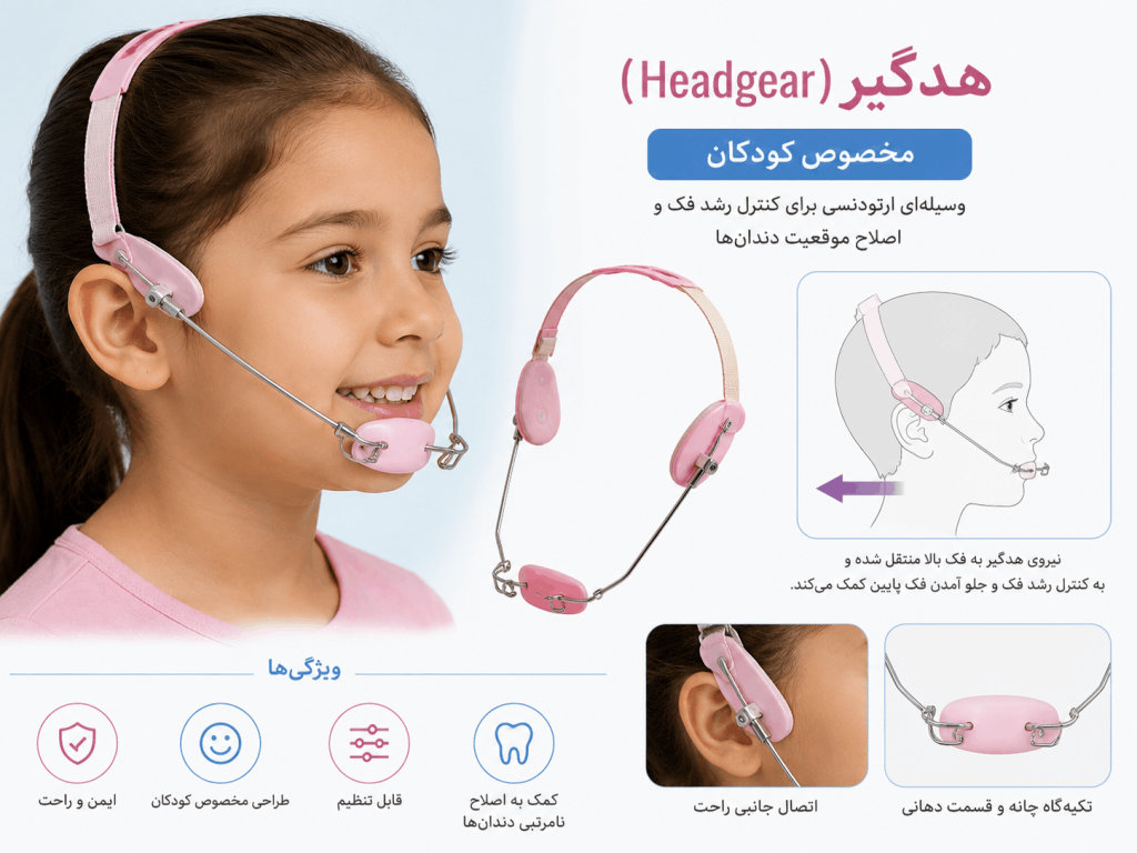 هدگیر (Headgear) – مخصوص کودکان