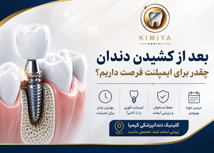 بعد از کشیدن دندان چقدر برای ایمپلنت فرصت داریم؟
