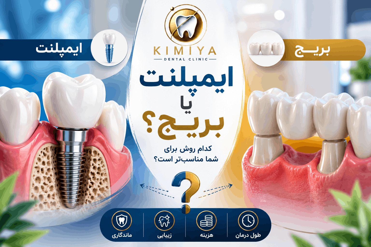 ایمپلنت بهتر است یا بریج