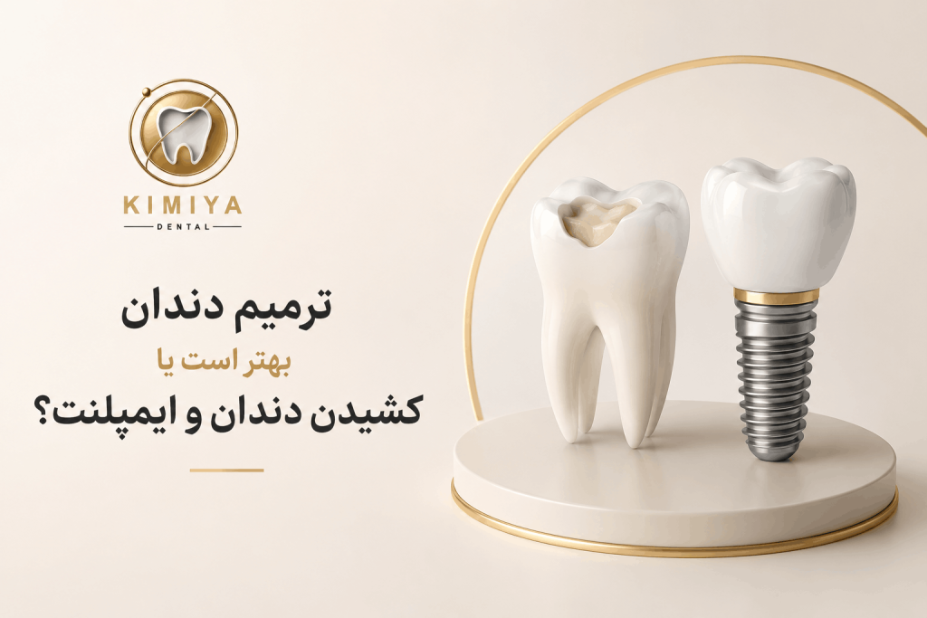 ترمیم دندان بهتر است یا کشیدن دندان و ایمپلنت