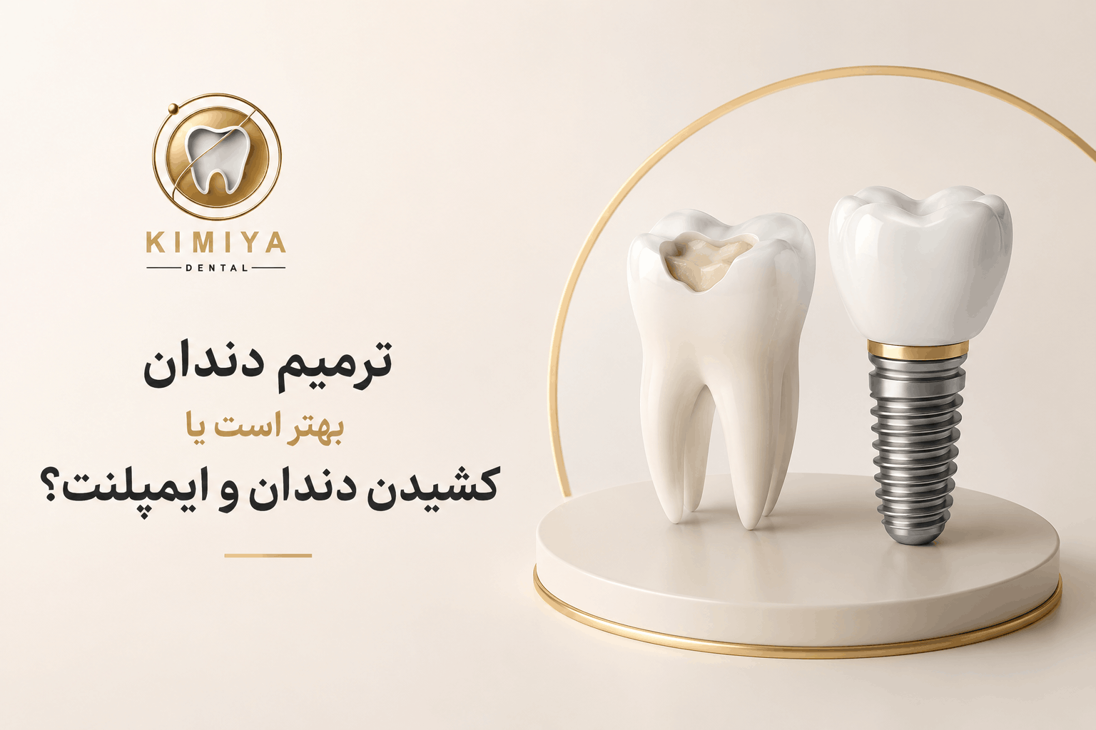 ترمیم دندان بهتر است یا کشیدن دندان و ایمپلنت