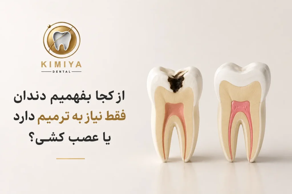 از کجا بفهمیم دندان فقط نیاز به ترمیم دارد یا عصب کشی؟