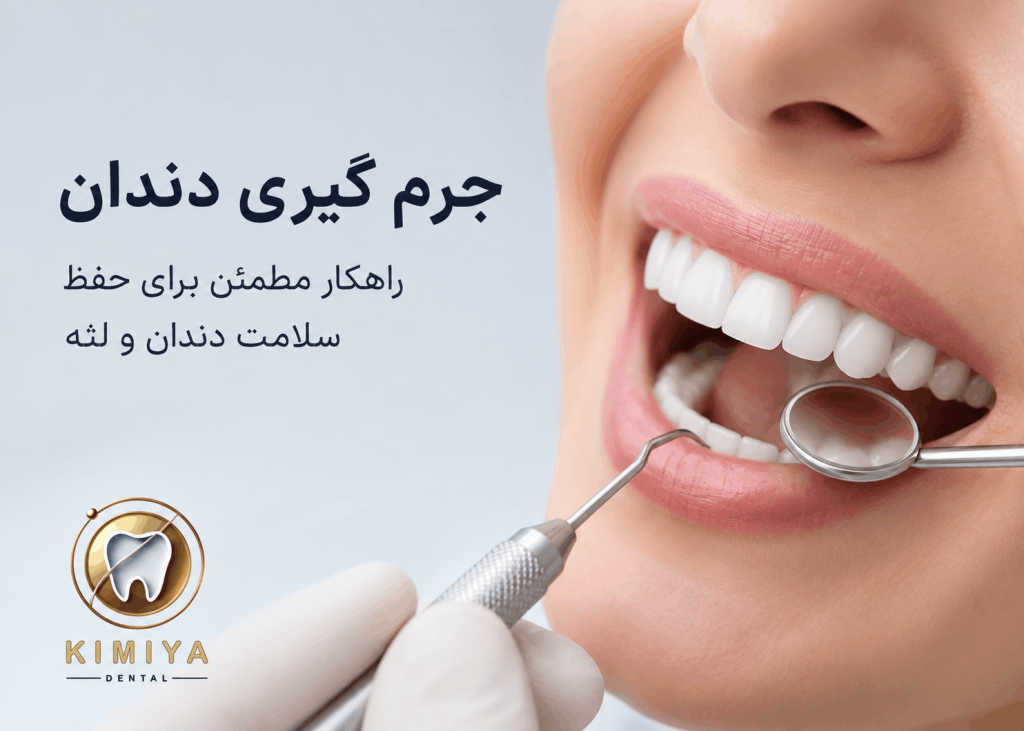 آیا جرم گیری دندان به مینای دندان آسیب می‌زند؟ حقیقتی که بسیاری از افراد نمی‌دانند