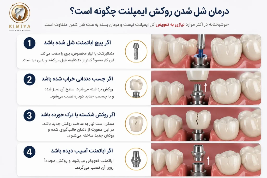 درمان شل شدن روکش ایمپلنت در کلینیک دندانپزشکی کیمیا در شهریار