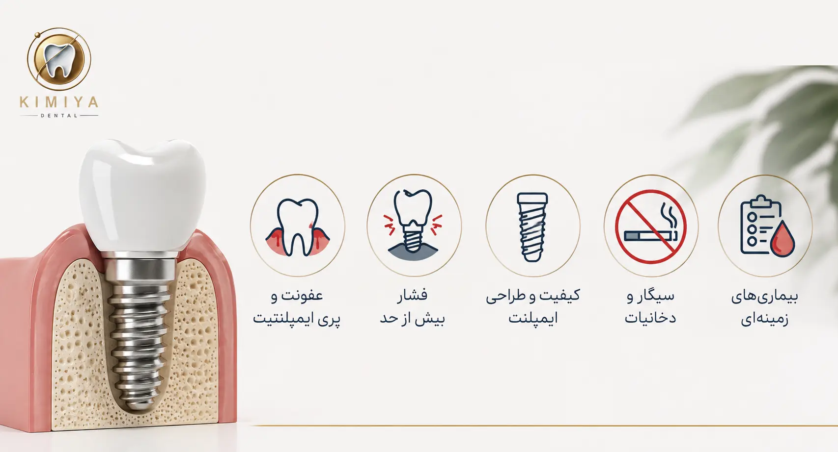 ۵ دلیل اصلی تحلیل استخوان اطراف ایمپلنت (و چطور از آنها پیشگیری کنیم)