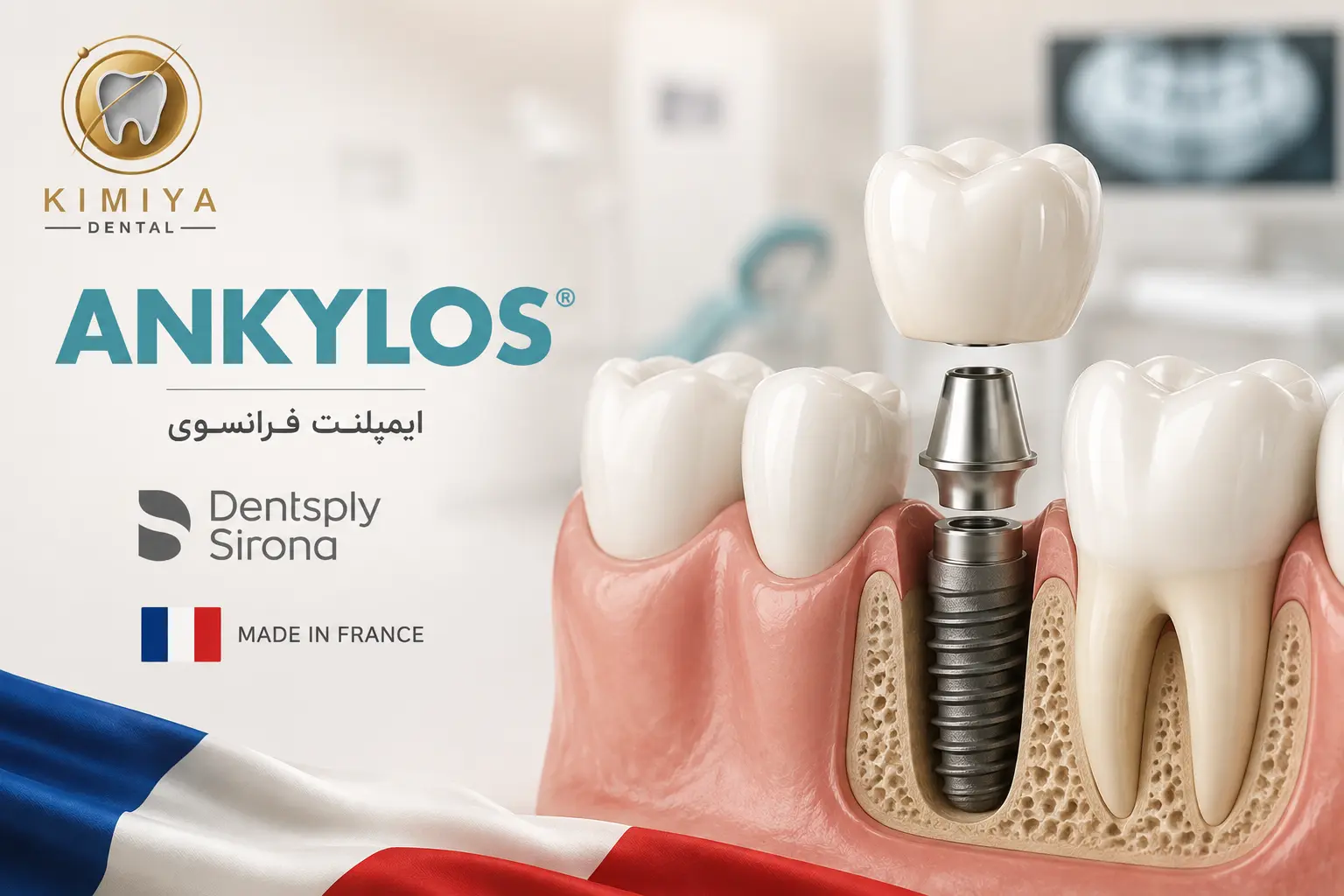 ANKYLOS (آنکیلوس) - برند زیرمجموعه Dentsply Sirona در شهریار