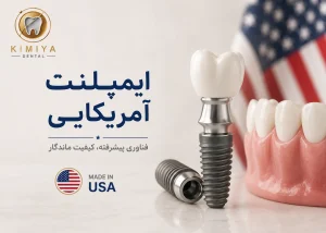 ایمپلنت آمریکایی در شهریار در کلینیک دندانپزشکی کیمیا در شهریار