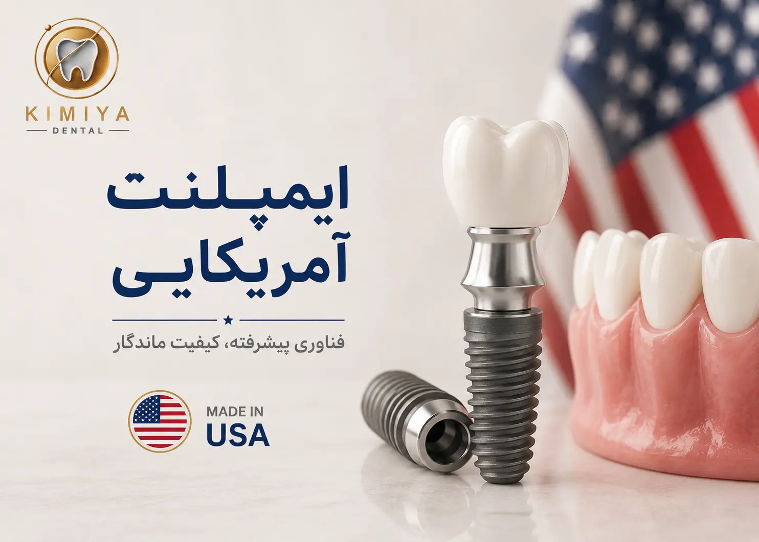 ایمپلنت آمریکایی در شهریار در کلینیک دندانپزشکی کیمیا در شهریار