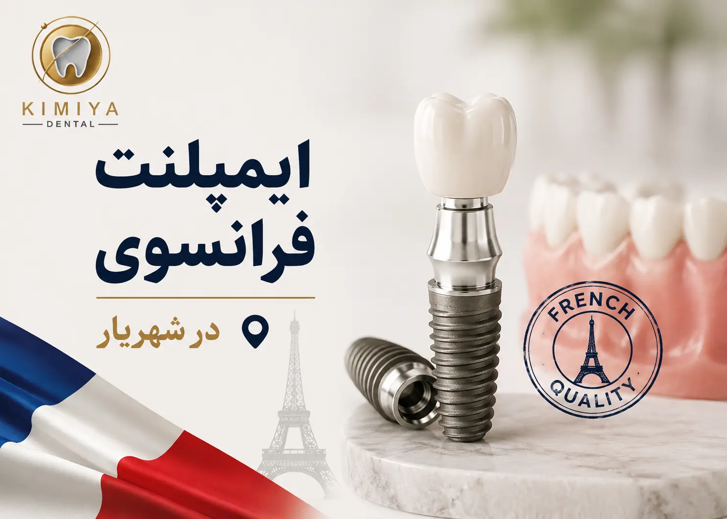 ایمپلنت فرانسوی در شهریار