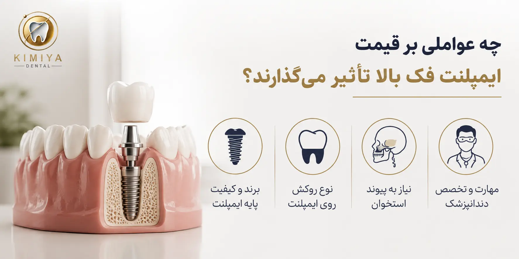قیمت ایمپلنت فک بالا ۱۴۰۵ در کلینیک کیمیا شهریار