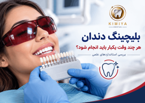فاصله بین جلسات بلیچینگ