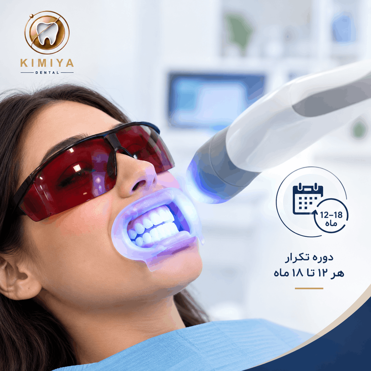 بلیچینگ در مطب در کلینیک دندانپزشکی کیمیا در شهریار